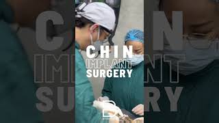 Chin augmentation goes beyond simple enhancement—it can also refine the lower third of the face [upl. by Anegal]