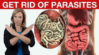 9 Tips to Get Rid of Parasites amp Candida  Dr Janine [upl. by Mortie]