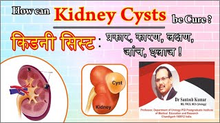 Kidney Cyst Kidney Tumor Kidney Cancer  किडनी सिस्ट  DrProfSantosh Kumar PGI [upl. by Nunnery]