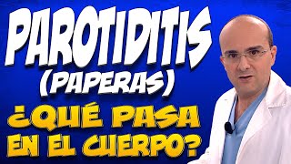 PAROTIDITIS o PAPERAS  ¿Qué pasa dentro del cuerpo de las personas que las padecen [upl. by Nnylsia410]