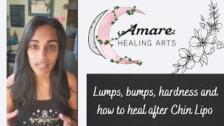 Lumps bumps hardness and how to heal after Chin Lipo [upl. by Cosmo525]