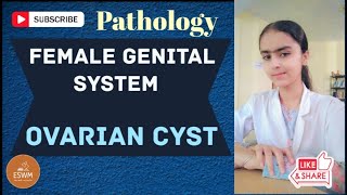 Ovarian Cyst PATHOLOGY Explained [upl. by Peace]