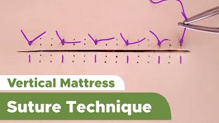 Suture Techniques and Training Series Interrupted Vertical Mattress Suture Technique [upl. by Koblick]