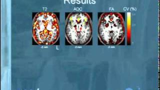 Reproducibility of quantitative cerebral T2 relaxometry DTI amp MRSI at 3T [upl. by Calia473]