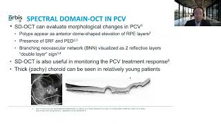 Lecture Polypoidal Choroidal Vasculopathy and Retinal Complications of Myopia [upl. by Ahsino]