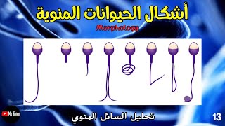 أشكال الحيوانات المنوية ح١٣ [upl. by Sherborn]