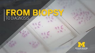 From Biopsy to Diagnosis [upl. by Yovonnda815]