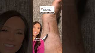 Dr Pimple Popper Reacts to Inflamed Ingrown That Looks SATISFYING to Pull Out [upl. by Wainwright]