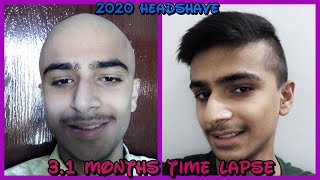 My 2020 Headshave 31 Months Hair Growth Time Lapse [upl. by Swarts]