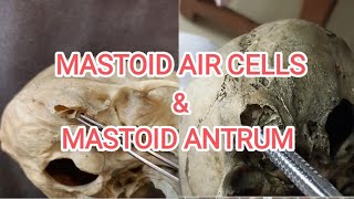 Mastoid air cells and mastoid antrum [upl. by Napoleon165]