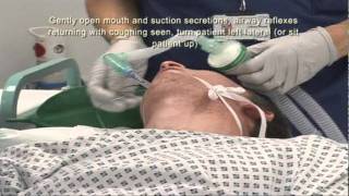 Intubation Extubation 67 [upl. by Hopkins]