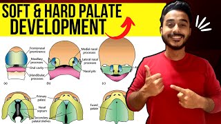 development of palate embryology  soft palate development embryology [upl. by Winn]