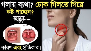 গলা ব্যথা দূর করার উপায়গলা ব্যথার ঘরোয়া উপায়What to do if sore throatGola betha dur korar upay [upl. by Ayela]