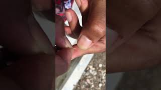 How to remove Metal Splinter from finger [upl. by Ardnuassac]