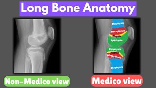 “Long Bone Anatomy Explained  Physis Epiphysis Metaphysis amp Diaphysis Overview” [upl. by Carr]