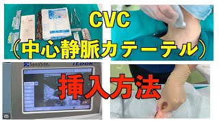 研修医必見❗CVC中心静脈カテーテルの挿入方法、手順 [upl. by Lauren921]