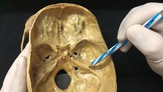 Skull Osteology  Cranial Cavity Anatomy [upl. by Aslam]