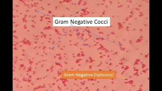 Gram negative cocci under microscope Gram negative diplococci Neisseria under microscope GNC [upl. by Goda673]