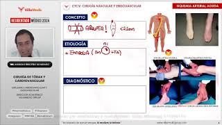 Residentado Villamedic Cirugía de tórax y cardiovascular  Insf Arterial Aguda CrónicaDisección [upl. by Silrac]