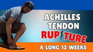 What to Expect with an Achilles Tendon Rupture  12 Weeks In [upl. by Hairabez]