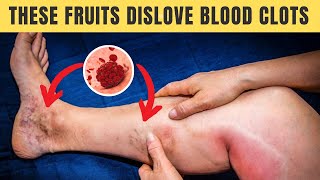 Top 7 FRUITS that Dissolve BLOOD CLOTS Naturally [upl. by Aicirpac]