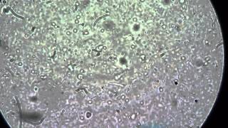 Smallest Creatures Under Microscope X200 How to Find Infusoria in Water Drop [upl. by Mcadams]