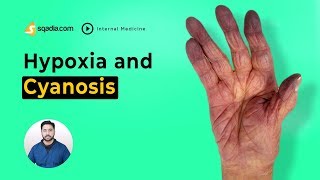 Hypoxia and Cyanosis  Medicine Video Lectures  Student Online  VLearning  sqadiacom [upl. by Giorgio]