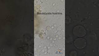 Blastocystis hominis in Stool [upl. by Acenahs]