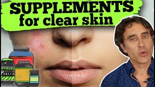 EAT THIS FOR PERFECT SKIN  Top 3 Supplements For Beautiful Skin [upl. by Seen905]