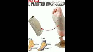 Flat Foot ko kaise thik kren How to treat Flat Foot ssc gd medical by Sanjeet Raj [upl. by Silado]