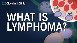 What Is Lymphoma [upl. by Gathard569]