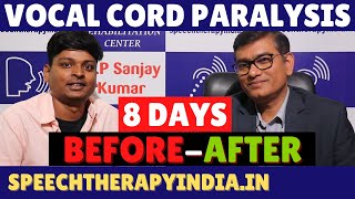 BeforeAfter  Unilateral Vocal Cord Paralysis Phonatory Gap  8 Days Voice Therapy  AIIMS Alumnus [upl. by Flynn464]