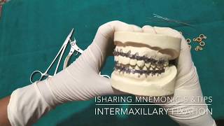 Intermaxillary fixation with Erich arch barspart 2 [upl. by Eldnik]