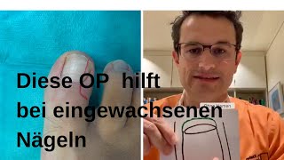 Hilfe bei eingewachsenen Zehenägeln [upl. by Revlys]