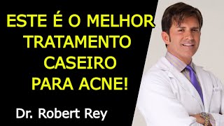 ESTE É O MELHOR TRATAMENTO CASEIRO PARA ACNE  Dr Rey [upl. by Leon]