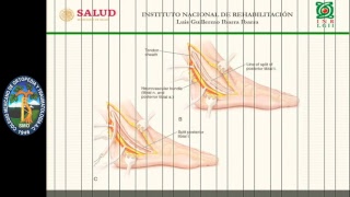 Sesión Ortopedia Pediátrica Marzo 2019 [upl. by Mari]