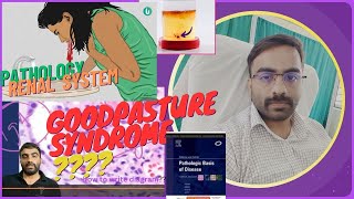 GOODPASTURE SYNDROME RPGN PART 18  NEPHROLOGY [upl. by Dalis]