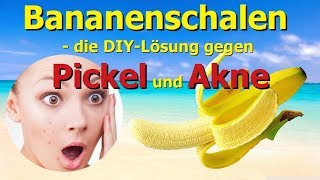 Bananenschalen  Die DIYLösung gegen Pickel und Akne [upl. by Repsaj838]