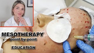 Mesotherapy for face full demo and point by point injection technique [upl. by Foulk]