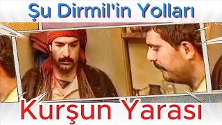 ŞU DİRMİLİN YOLLARI  KURŞUN YARASI [upl. by Iron]