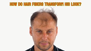 How do Hair Fibers Transform His Look [upl. by Razaile510]