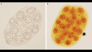 DipylidiumCaninum Infektion mit Gurkenkernbandwurm [upl. by Moffitt]