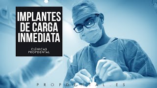 Cirugía de la colocación de implantes carga inmediata [upl. by Dorita]