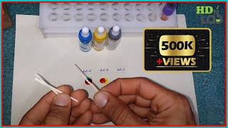 Blood Group Testing Experiment  StepbyStep Guide at Harib Diagnostic Lab [upl. by Edlitam]