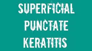 Ophthalmology Superficial punctate keratitis [upl. by Ennoirb]