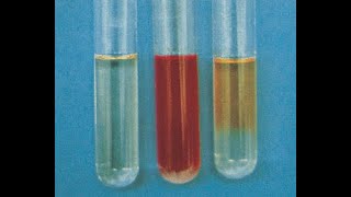 Methyl Red MR Test Principle Procedure and Results [upl. by Imef]