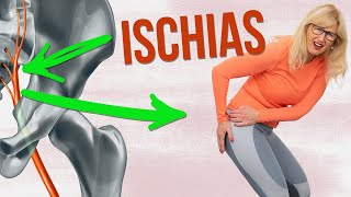 Ischias Übungen ✅ Meine 2 besten Übungen bei Ischias Schmerzen [upl. by Algy]