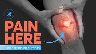 Chondromalacia Patellae  Runner’s Knee  Knee Pain Exercises  Knee Cap Pain [upl. by Rafter]