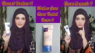 Mistine Acne Clear Facial Foam Review  My Experience amp Honest Review [upl. by Levon]