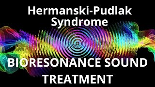 Hermanski Pudlak SyndromeSound therapy sessionSounds of nature [upl. by Emmer]